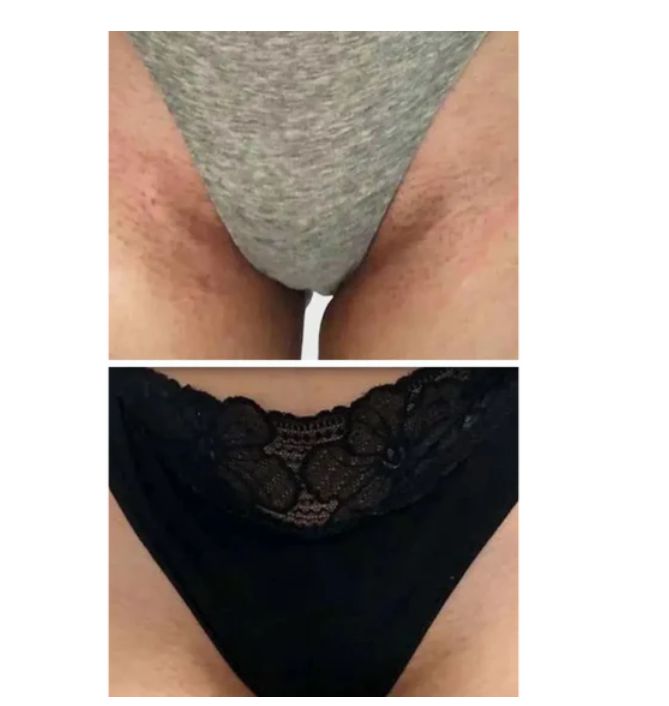 Natural Fix – Combo anti acné y manchas